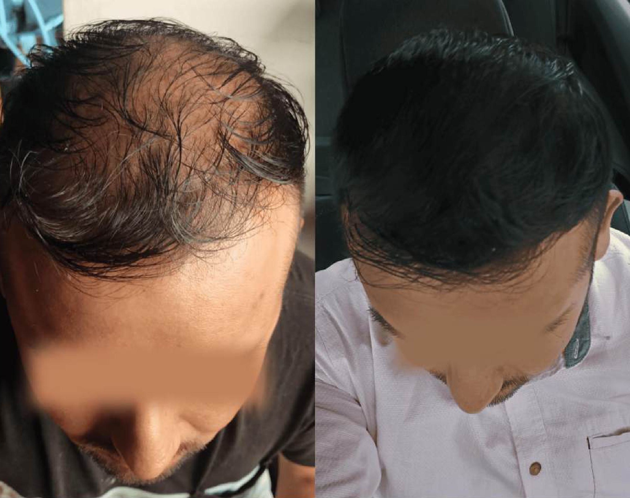 Antes y después Testimonio 5