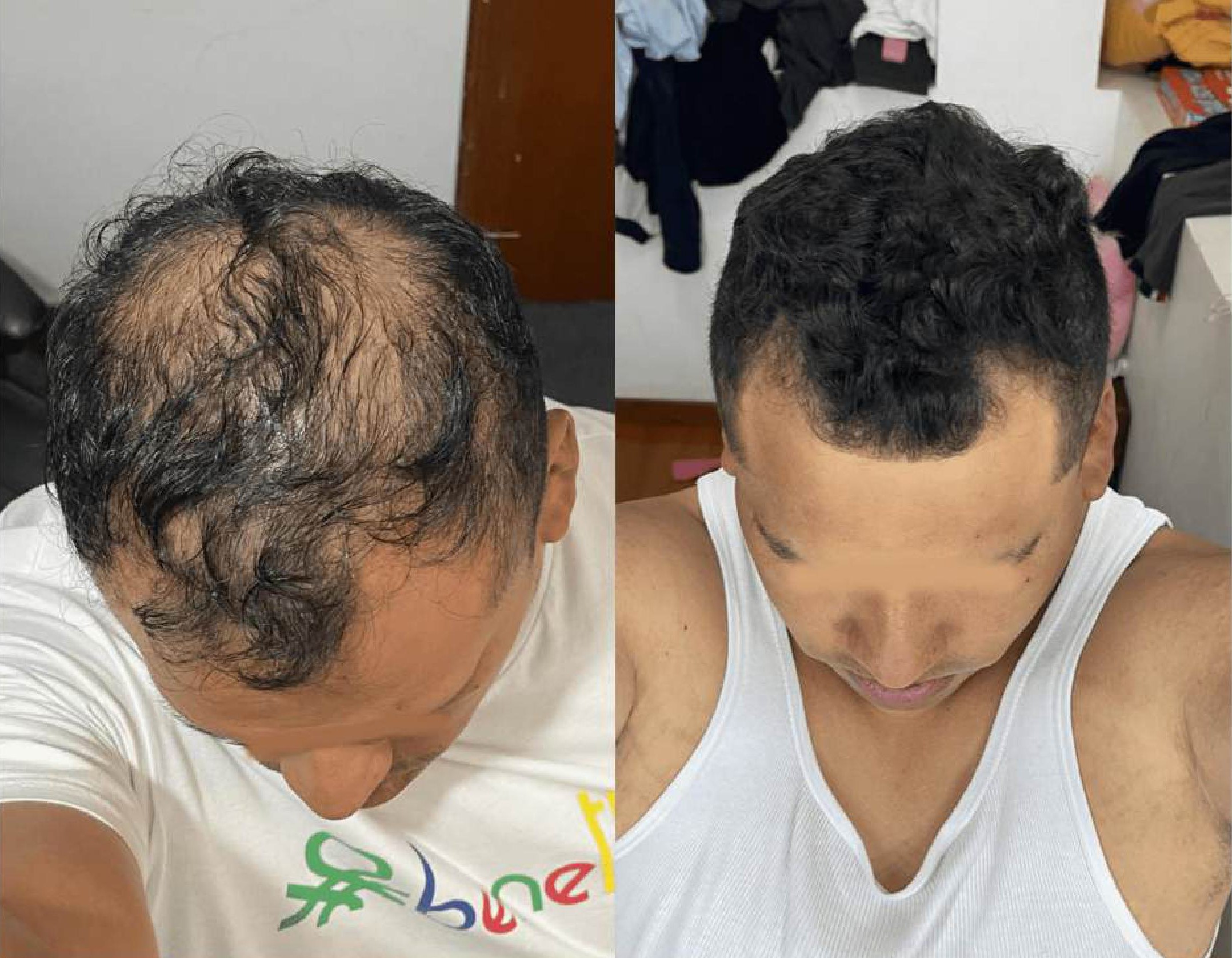 Antes y después Nicolás Ramírez