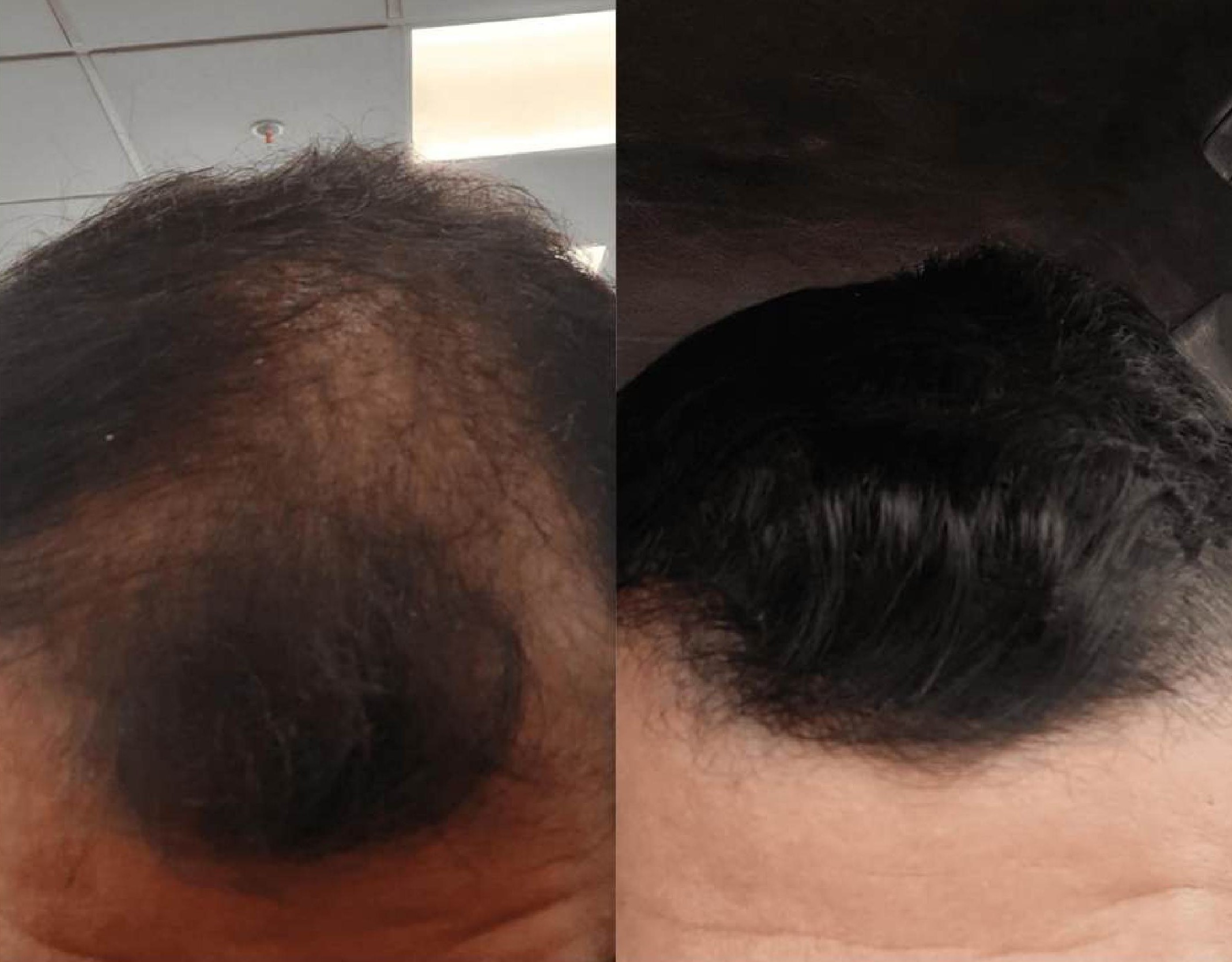 Antes y después Andrés Silva