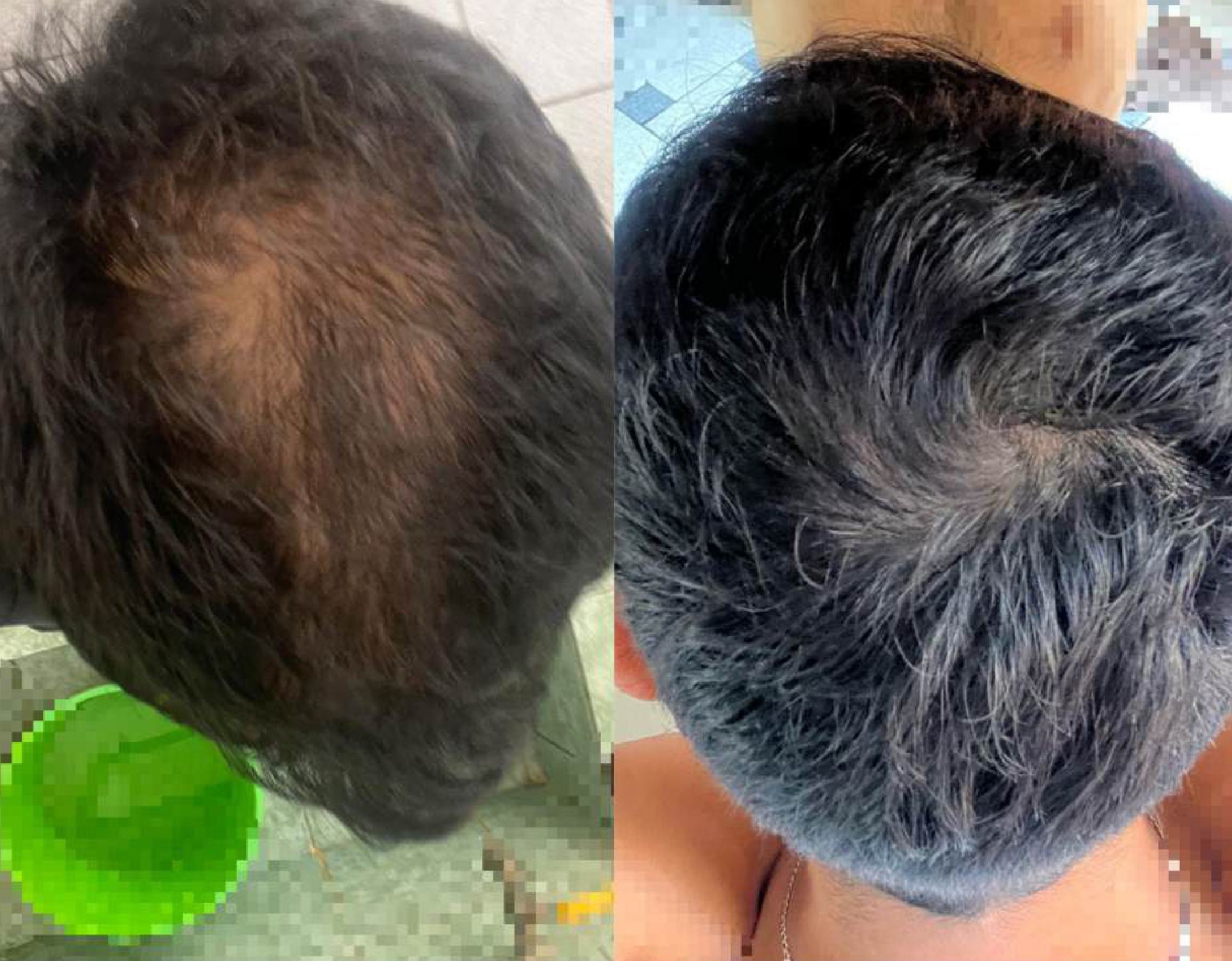 Antes y después Testimonio 4