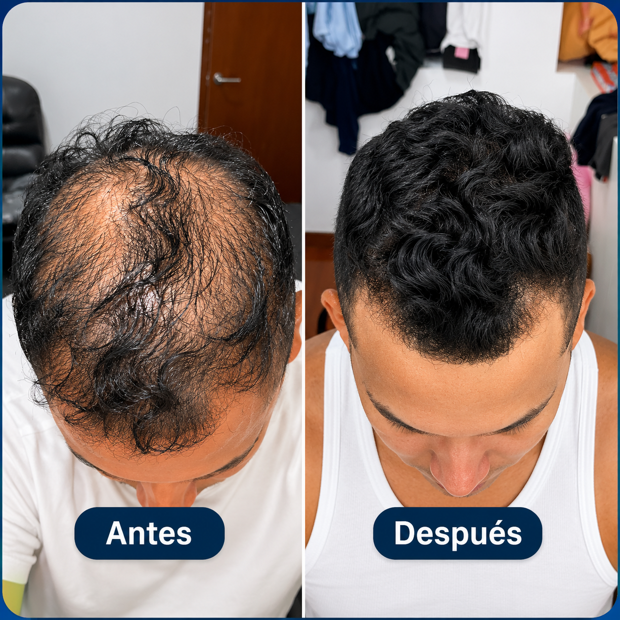 Resultado antes y después - caso 2