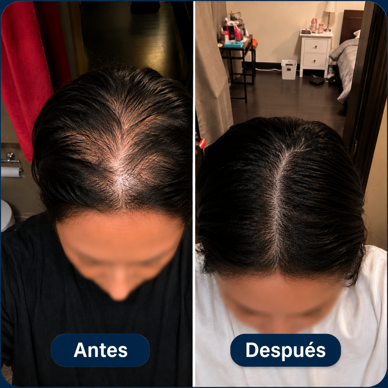 Resultado antes y después - caso 1